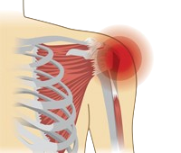 ayurveda for shoulder pain